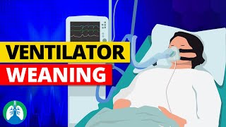 Weaning from Mechanical Ventilation  Criteria and Parameters [upl. by Aihsrop]