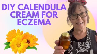 DIY ORGANIC CALENDULA CREAM FOR ECZEMA VIDEO 2022 [upl. by Ytirev]