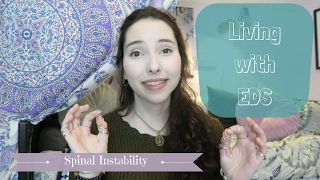 Living with EDS Spinal Instability [upl. by Analim]