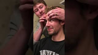 Blackheads New 2022 today  Big Pimples on Face Treatment [upl. by Erual]