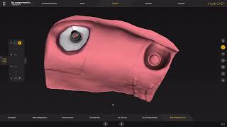 Brugstructuren op Multi unit abutments in de inLab 22 software [upl. by Fakieh489]