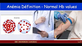 Lecture 121 Anemia Definition Normal Hb values [upl. by Murtha]