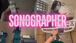 WEEK IN MY LIFE Registered Diagnostic Medical Sonographer aka ultrasound technologist [upl. by Ulani632]