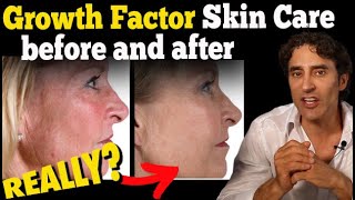 IS GROWTH FACTOR SKIN CARE WORTH IT  Dr Rajani [upl. by Bellis]