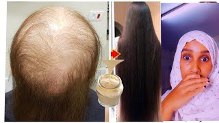 firi sirta gawadheyda timaha ubixise 😱 secret for hair growth [upl. by Annabela]