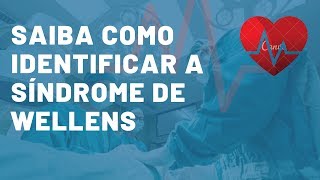 Saiba como identificar a Síndrome de Wellens [upl. by Oruam]