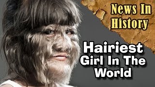 Hairiest Girl In The World  News In History [upl. by Akisey]