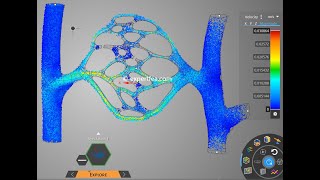 Hemodynamics of Free and Obstructed Blood Flow Through Capillaries  ANSYS Discovery 2021 R1 [upl. by Atter319]