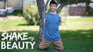 Man With No Arms Or Knees Becomes Internet Sensation  SHAKE MY BEAUTY [upl. by Abe]