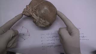 The Fetal Skull Antero Poterior Diameters  By Love Obstetrics and Gynecology [upl. by Yot]