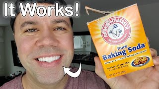 How to Whiten Teeth Safely and Naturally  How to Make Teeth More White [upl. by Darius485]