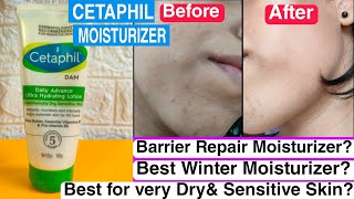 CETAPHIL Daily Advance Ultra Hydrating Lotion Review✅Best Winter Moisturizer For Dry Skin [upl. by Secunda]