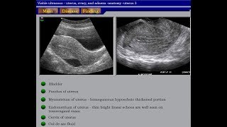 Ultrasound Course of Gynecology Part 01 [upl. by Sybille605]