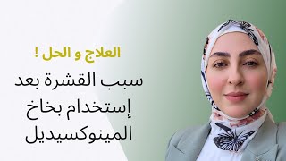 سبب ظهور القشرة بعد إستخدام المينوكيسيديل و طريقة العلاج [upl. by Acima]