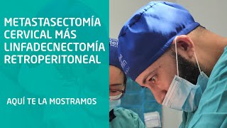 Metastasectomía cervical más linfadenectomía retroperitoneal [upl. by Wake632]