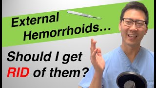 External hemorrhoid treatment Should I REMOVE or LEAVE them [upl. by Ttereve]