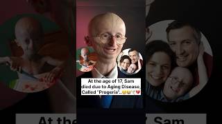 SAM BERNS✨❤️  Life Journey  shorts successstory motivation samberns journey ytshorts [upl. by Alphard]