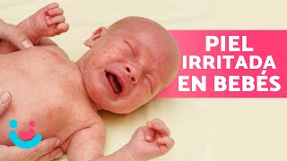 ¿Cómo CURAR un SARPULLIDO a mi BEBÉ 🤱🏻🧼 Remedios Caseros [upl. by Nadnal]