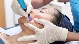 Microneedling Full Training Video [upl. by Kcod]