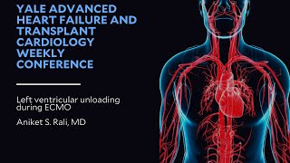 Left ventricular unloading during ECMO [upl. by Tran]