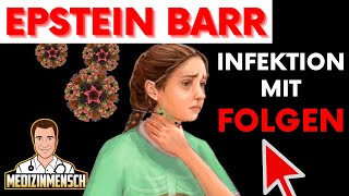 Epstein Barr Virus Die Immunologischen Folgen EBV Infektion wissenschaftlich erklärt [upl. by Osborn]