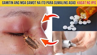 TOP 5 na EFFECTIVE na GAMOT para sa KAGAT NG IPIS [upl. by Annyl]