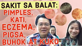 Sakit sa BALAT Pimples Kati Eczema Kanser Pigsa Buhok at Kuko  Payo ni Doc Willie Ong 186 [upl. by Glarum484]