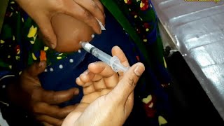 Arm injection IM Soma Ject Injection Push √√ Injection Video  জন্মবিরতিকরণ ইনজেকশন 24 Ep14 [upl. by Ellesij]