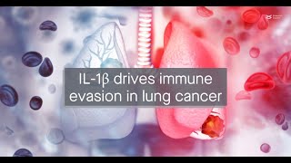 IL1β upregulates immune checkpoint regulators to promote immune evasion in lung adenocarcinoma [upl. by Connor]