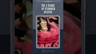 The Three Signs of Stomach Ulcers shorts [upl. by Enitsirt]