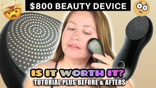 🤯 800 beauty device  IS IT WORTH IT  Nebulyft N1 Radio Frequency  TUTORIAL w BEFORE amp AFTERS [upl. by Inglebert208]