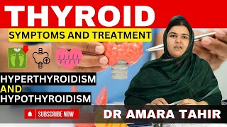 Thyroid problems  symptoms and treatment  Dr Amara Tahir [upl. by Hey]