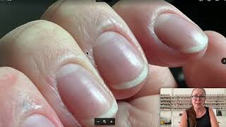 Swollen and puffy quotcuticlesquot advice Annas Nail Advice [upl. by Atiuqa]