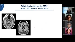 Overview of MCI and Dementia  James Lah MD PhD [upl. by Yedoc]