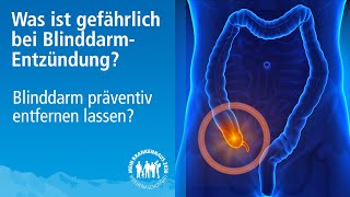 Blinddarmentzündung erkennen  Anzeichen einer gefährlichen AppendizitisBlinddarm OP erforderlich [upl. by Adnoyek]