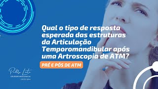 Qual resposta é esperada das estruturas da Articulação Temporomandibular pós Artroscopia de ATM [upl. by Aned]