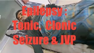 Epilepsy  Types of clonic seizureTonic amp clonic phase  JVP [upl. by Mclaurin]