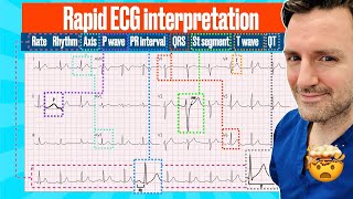 Rapid structured ECG interpretation A visual guide FOR REVISION electrocardiogram [upl. by Amice205]