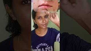 Reequil Ceramide and hyaluronic acid moisturizer Malayalam reviewmoisturizer for dry skin 🫡myntra [upl. by Aneelahs]