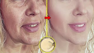 Homemade Anti aging Cream That Works Magic Get Baby like Skin in Just 7 Days [upl. by Auqinet304]