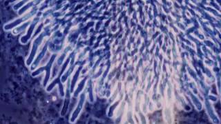 Clinical Mycology Direct Examination Series Aspergillus Hot Topic [upl. by Enomes]