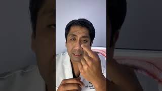 CONJUNTIVITIS TIPOS Y TRATAMIENTO DR VICTOR TORREALVA OFTALMÓLOGO [upl. by Natascha23]