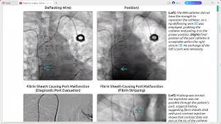 INTERVENTIONAL RADIOLOGY DIAGNOSTIC IMAGING SERIES [upl. by Itoyj]