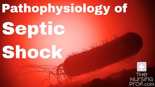 Pathophysiology of Septic Shock [upl. by Philo819]