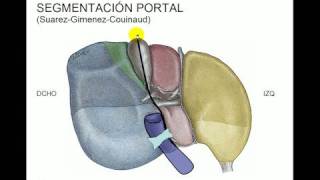 Segmentacion hepática [upl. by Vesta]