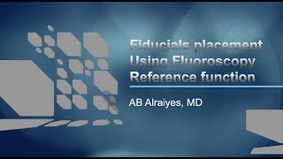 Fiducial Markers Placement Using REBUS and ION robotic bronchoscopy Fluoroscopy Reference Function [upl. by Josefa684]