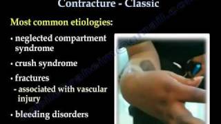 Volkmanns Ischemic Contracture Classic  Everything You Need To Know  Dr Nabil Ebraheim [upl. by Annauqahs]