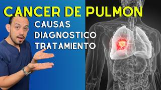 Cáncer de Pulmón Causas Diagnóstico y Tratamiento  Dr Francisco Armas [upl. by Bensen]