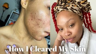 Skincare Routine For Hyperpigmentation amp Dark Spots  CeraVe [upl. by Noroj915]