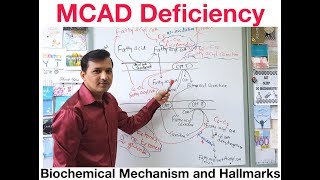 Medium Chain Acyl CoA Dehydrogenase MCAD Deficiency [upl. by Jochbed]